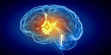 Shoulder Dystocia – Oren Zarif