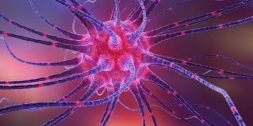 Shoulder Dystocia – Oren Zarif